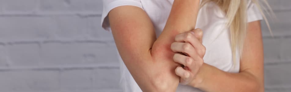 Skin Allergy Testing Los Angeles CA