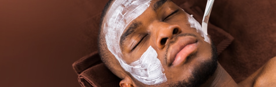 Chemical Peels Los Angeles CA