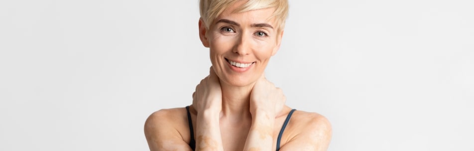 Excimer Laser Therapy Los Angeles CA
