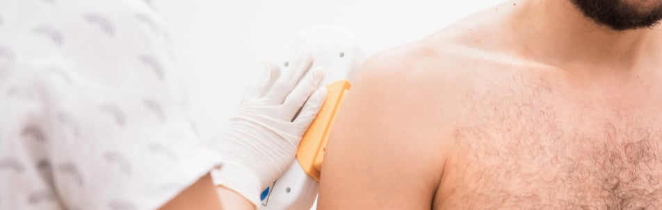 Laser Hair Removal Los Angeles CA