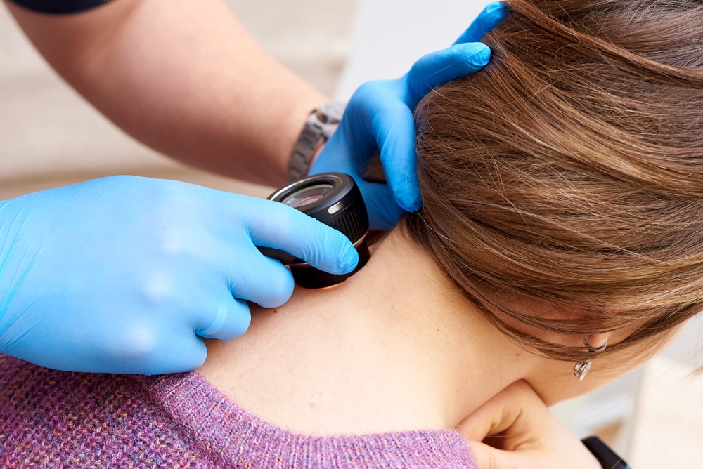 Gloved hand examining the back of a person's neck with a dermatoscope