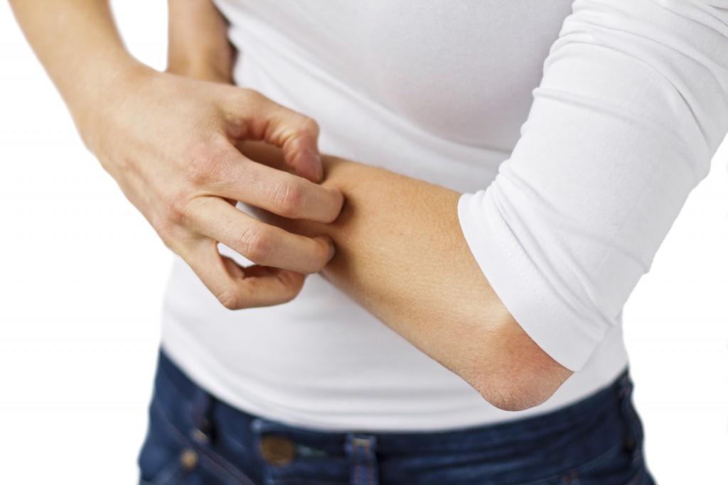 Itchy skin