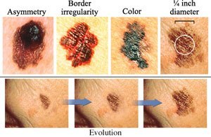 Images courtesy of the National Cancer<br> Institute<br> <a href="https://www.cancer.gov" target="_blank" rel="noopener">https://www.cancer.gov</a>