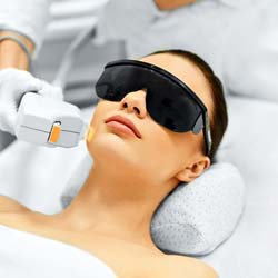 Woman with laser treatment
