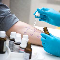Skin Allergy Testing
