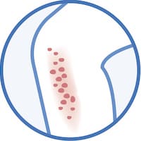 Skin diseases symbols with text
