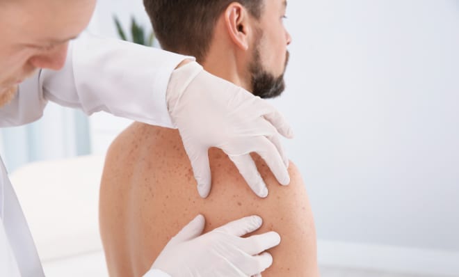 dermatologist examining the skin on a man's shoulder