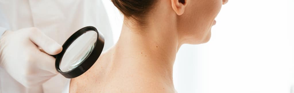 cropped view of dermatologist holding magnifying glass while woman picture id1152216002