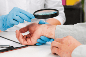 A dermatologist wearing gloves examines the skin of a sick patient.