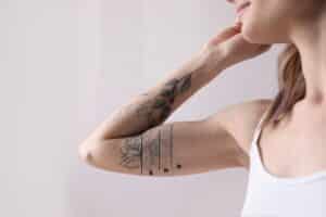 Image of woman’s arm with tattoo, showing it gradually fading after several tattoo removal treatments.