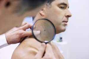 Dermatologist examining mole on man's neck in skin exam