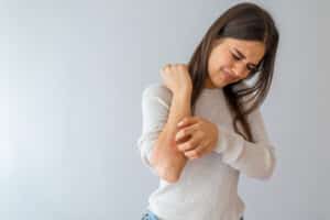 Woman scratching her arm from springtime hives in Los Angeles, CA