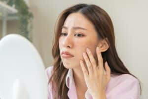 Concerned woman looking in the mirror at her melasma in Los Angeles, CA