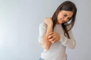 Woman itching her arms due to eczema flare up in Los Angeles, CA